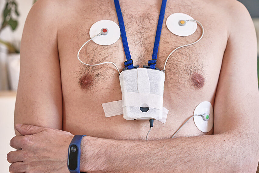 Holter Monitor and Loop Recorder in Agra